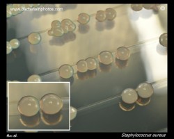 Staphylococcus aureus white (nonpigmented) colonies, staph without yellow pigment